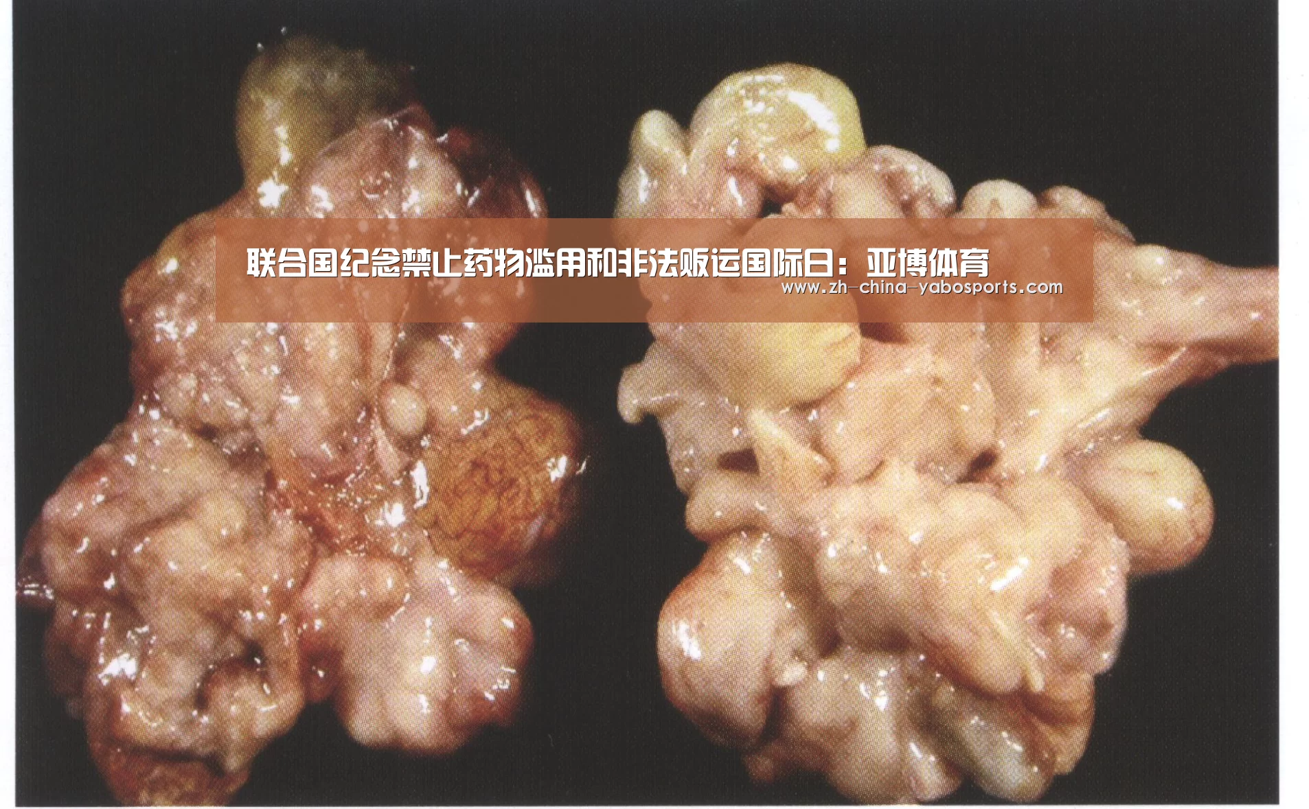 Yabo亚博官方网站